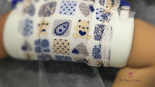 portada-arnes-frejka-freica-freika-freyca-frejca-displasia-cadera-neonatal-tratamiento-traumatologo-infantil-juan-cabello