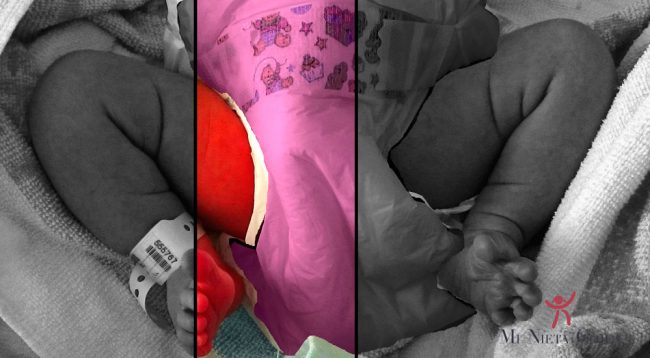 portada-doble-panal-panal-displasia-cadera-tratamiento-traumatologo-infantil-juan-cabello