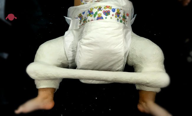 portada-cuidado-yeso-pelvipedico-traumatologo-infantil-juan-cabello