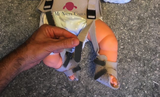 como-poner-arnes-pavlik-paulik-portada-traumatologo-infantil-juan-cabello15