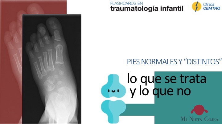 portada-pie-normal-distinto-traumatologo-infantil-juan-cabello2