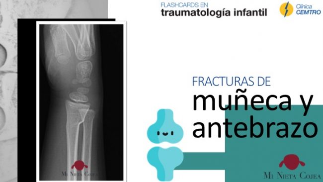 portada-fracturas-antebrazo-muñeca