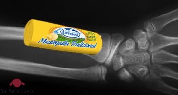 fractura-rodete-barra-mantequilla