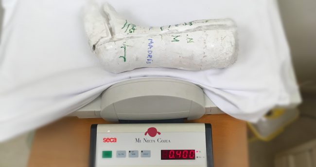 cuanto-pesa-escayola-portada